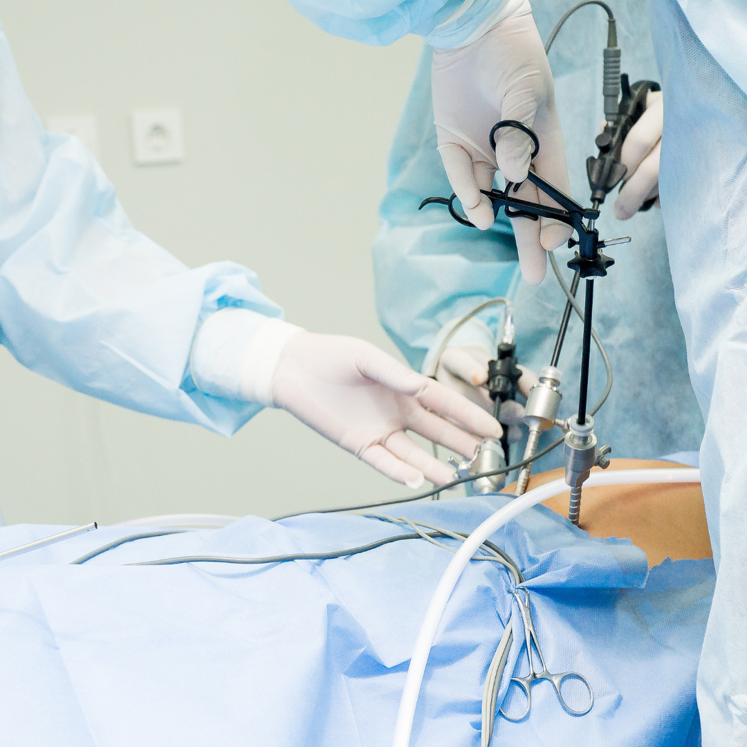 Laparoscopic Surgery at Suprem Multispeciality Hospital Nashik 2