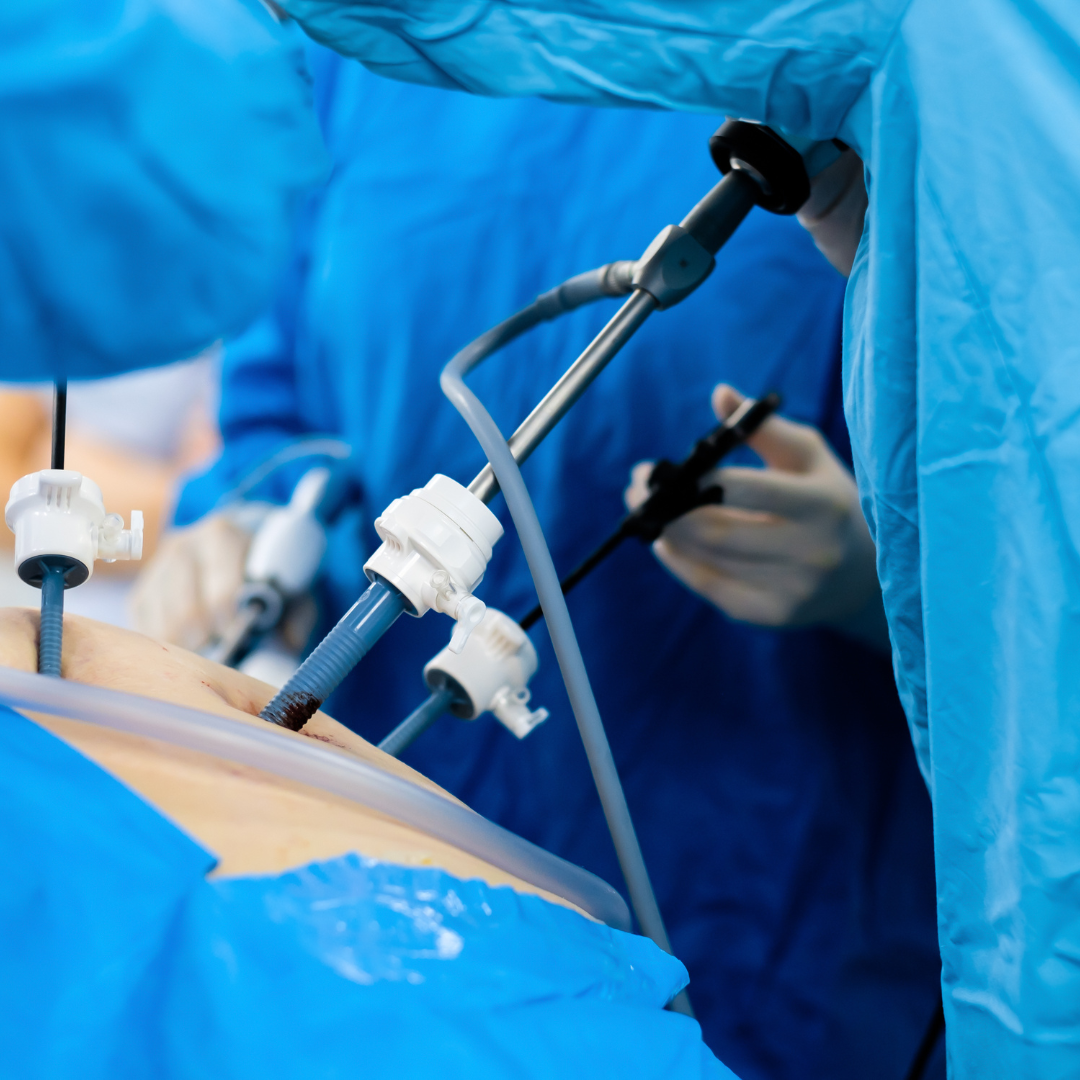 Laparoscopic Surgery at Suprem Multispeciality Hospital Nashik